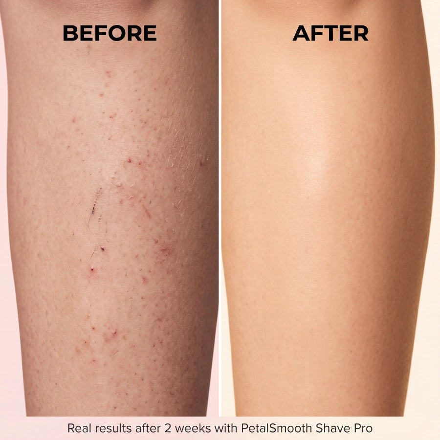 PetalSmooth™ Shave Pro