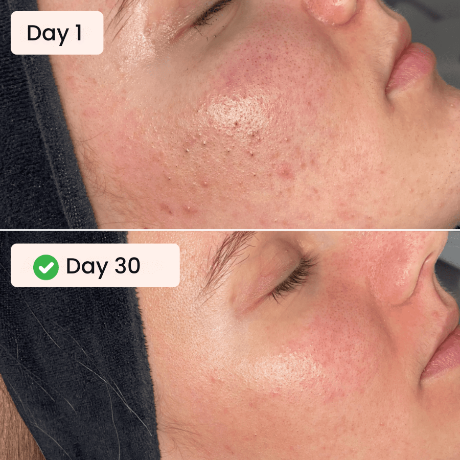 Exfoliating Glove for Body and Face