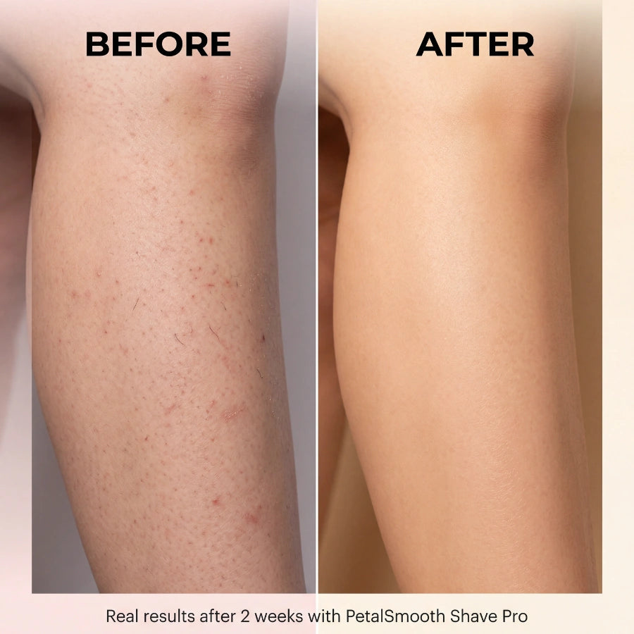 PetalSmooth™ Shave Pro