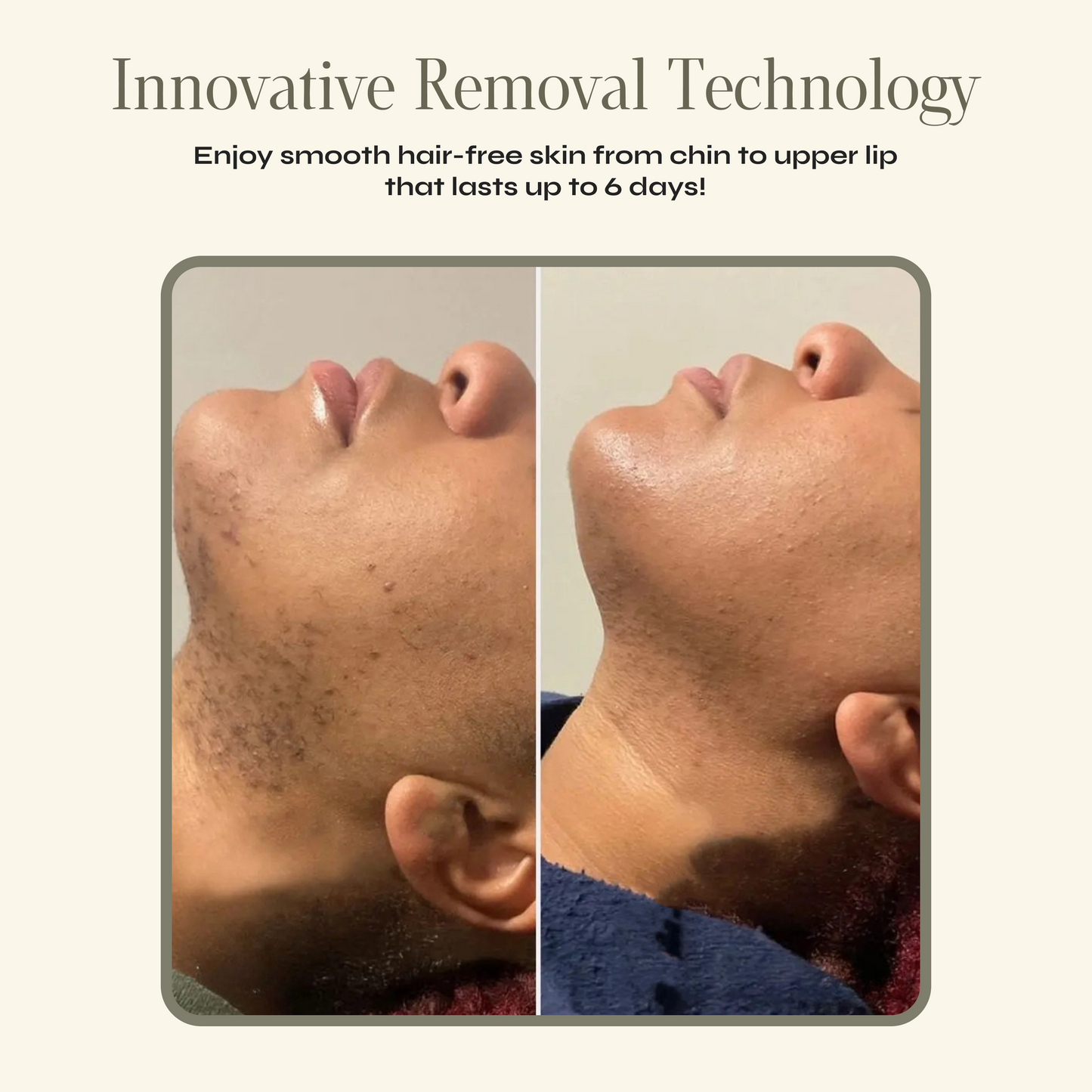 Facial Hair Removal Cream + Calming Serum