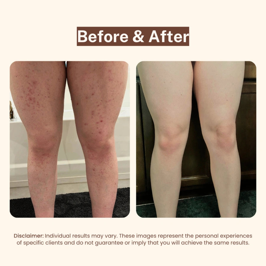 PetalCare Serum