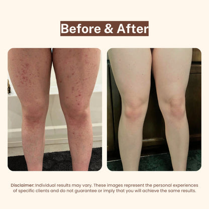 PetalCare Serum