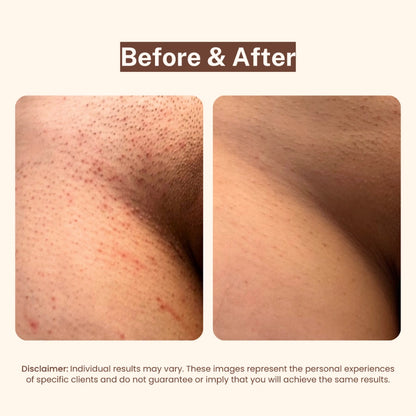 PetalCare Serum