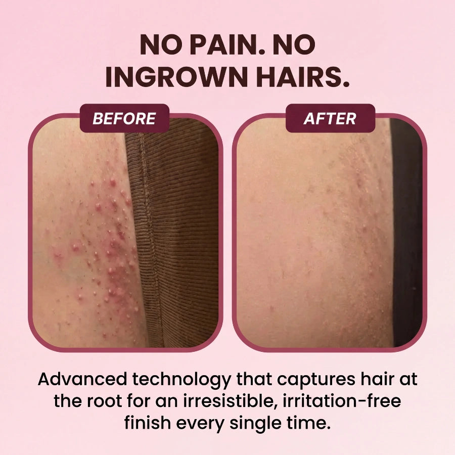 PetalSmooth™ Shave Pro