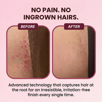 PetalSmooth™ Shave Pro