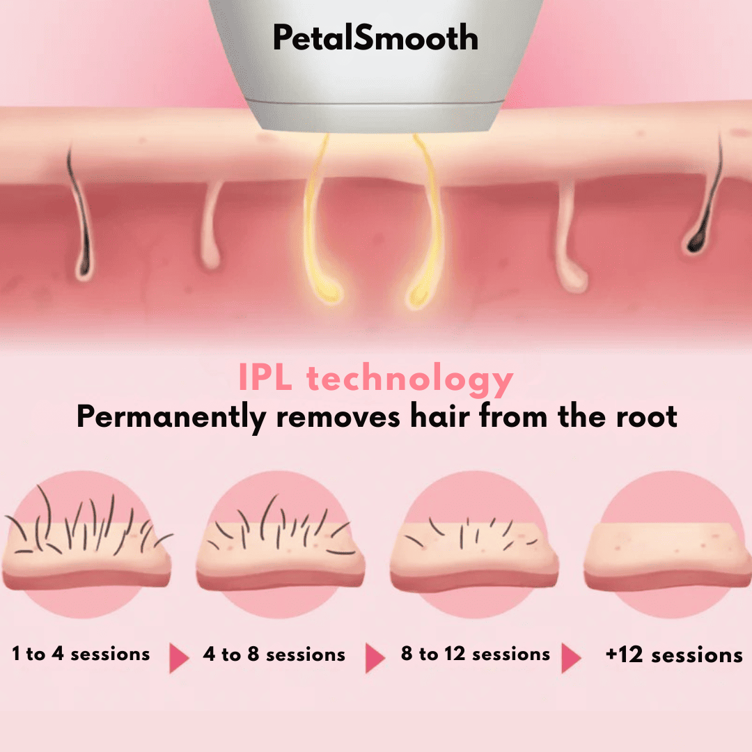 PetalSmooth IPL Pulse V2.0