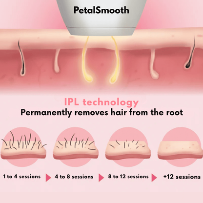 PetalSmooth IPL Pulse V2.0