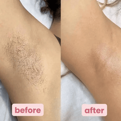 PetalSmooth™ Shave Pro